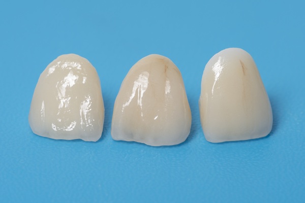 CEREC Crowns In A Single Visit