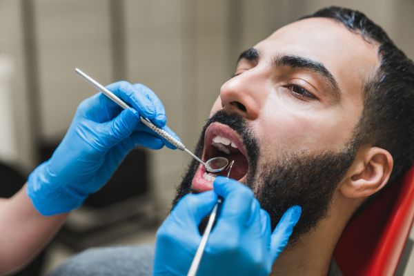 How Long Do Dental Fillings Last?