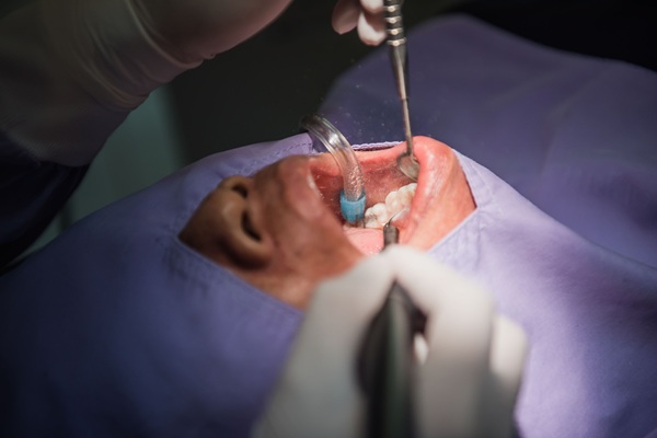 Oral Surgery Procedures FAQs