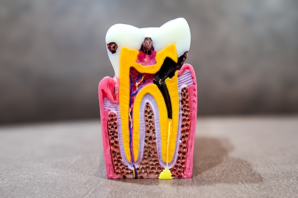 Root Canal Vs  Extraction: Make The Right Choice For Your Oral Health